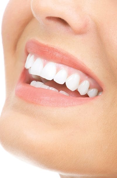 Beautiful healthy white teeth dental poster