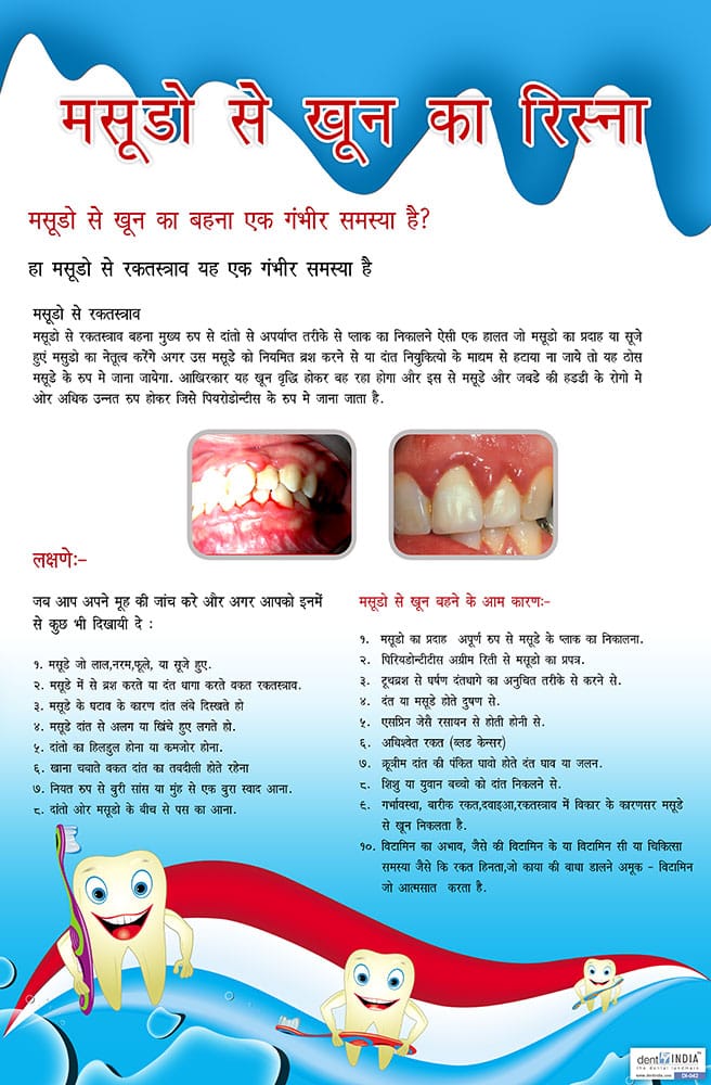 Hindi dental clinic awareness poster explaining bleeding gums, their symptoms, possible causes, and the importance of dental care