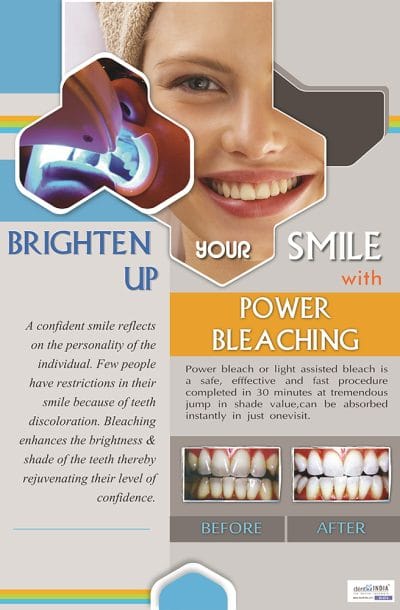 Professional teeth whitening dental poster