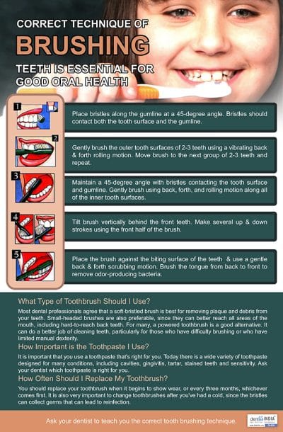 Correct tooth brushing technique educational poster