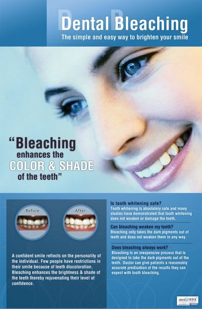 Dental bleaching teeth whitening awareness poster
