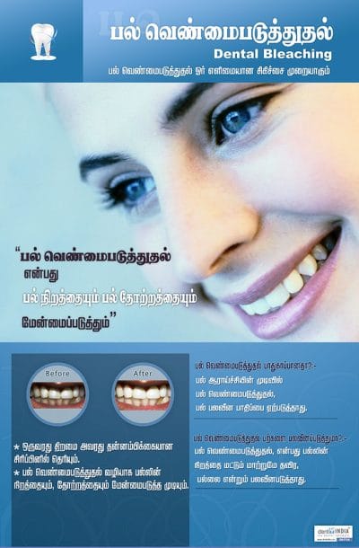 Tamil dental awareness poster explaining professional dental bleaching and teeth whitening treatment