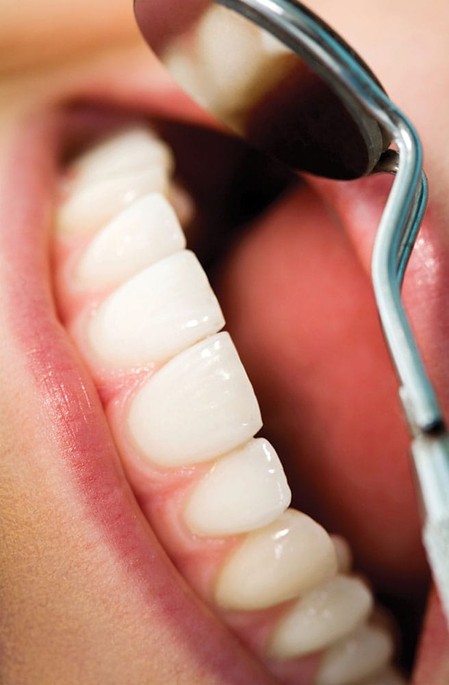 Dental instrument and healthy tooth close up poster