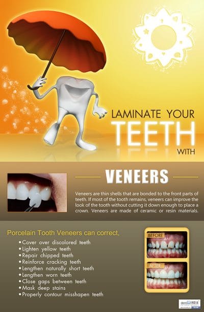 Porcelain dental veneers cosmetic dentistry poster