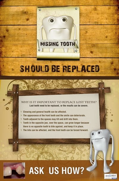 Missing teeth replacement awareness poster