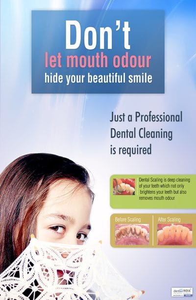 Professional dental cleaning awareness poster
